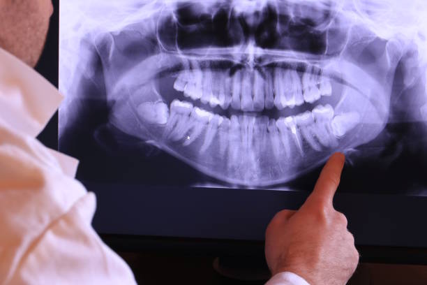 Best 24-Hour Emergency Dental Care in Mount Vernon, MD